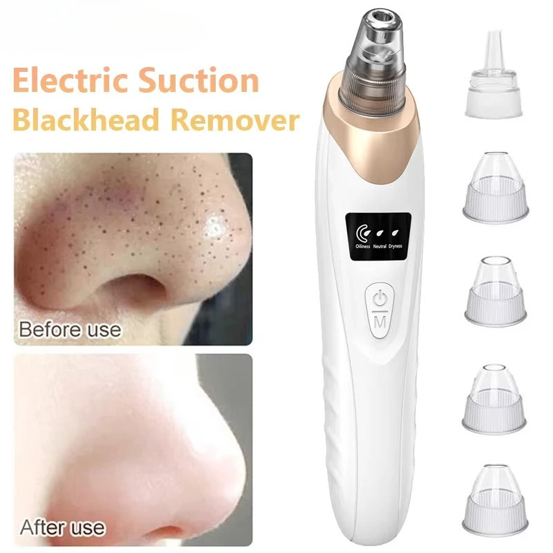 5-in-1 Electric Blackhead Vacuum – Deep Pore Cleaner & Acne Remover
